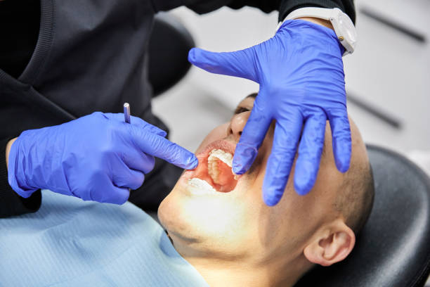 Best Broken or Chipped Tooth Repair in Youngstown, NY